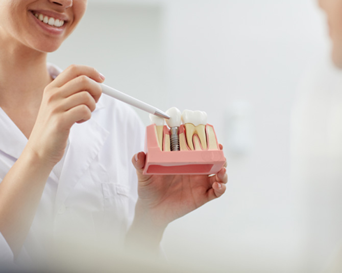 Dental implants can fail due to a condition called peri-implantitis
