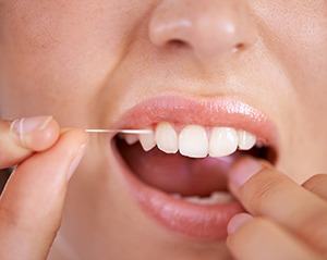 Be sure to maintain your oral health following scaling and root planing treatment