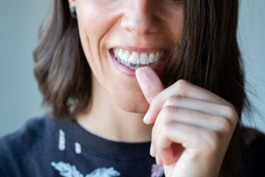 A woman putting in an Invisalign aligner tray.